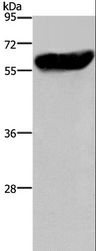 CYP2E1 Antibody - Western blot analysis of Mouse liver tissue, using CYP2E1 Polyclonal Antibody at dilution of 1:300.