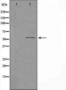CYP2E1 Antibody - Western blot analysis of extracts of K562 cells using Cytochrome P450 2E1 antibody. The lane on the left is treated with the antigen-specific peptide.