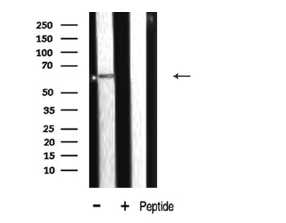 CYP2E1 Antibody - Western blot analysis of CYP2E1 expression in mouse liver tissue lysate
