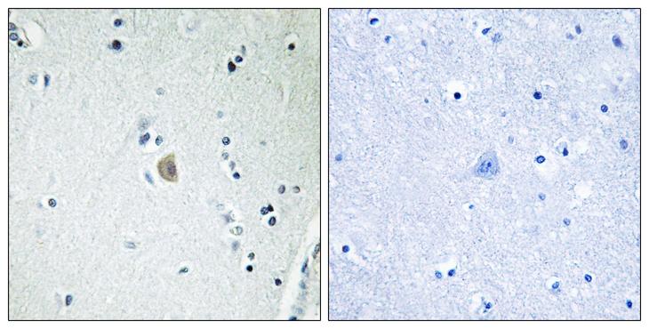 CYP2E1 Antibody - Peptide - + Immunohistochemistry analysis of paraffin-embedded human brain tissue, using Cytochrome P450 2E1 antibody.