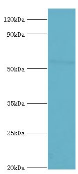 CYP2F / CYP2F1 Antibody - Western blot. All lanes: Cytochrome P450 2F1 antibody at 8 ug/ml+A549 whole cell lysate. Secondary antibody: Goat polyclonal to rabbit at 1:10000 dilution. Predicted band size: 56 kDa. Observed band size: 56 kDa Immunohistochemistry.