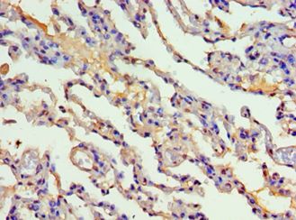 CYP2F / CYP2F1 Antibody - Immunohistochemistry of paraffin-embedded human lung using antibody at 1:100 dilution.