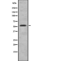 CYP2F / CYP2F1 Antibody - Western blot analysis of Cytochrome P450 2F1 using Jurkat whole cells lysates