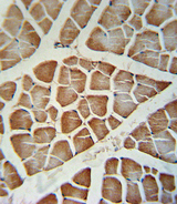 CYP2J2 Antibody - CYP2J2 Antibody immunohistochemistry of formalin-fixed and paraffin-embedded human skeletal muscle followed by peroxidase-conjugated secondary antibody and DAB staining.