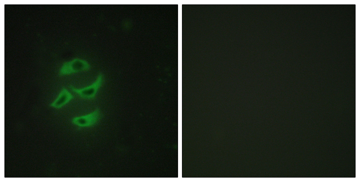 CYP2J2 Antibody - Immunofluorescence analysis of HepG2 cells, using Cytochrome P450 2J2 Antibody. The picture on the right is blocked with the synthesized peptide.