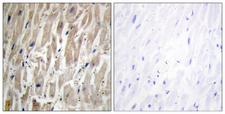 CYP2J2 Antibody - Immunohistochemistry analysis of paraffin-embedded human heart tissue, using Cytochrome P450 2J2 Antibody. The picture on the right is blocked with the synthesized peptide.