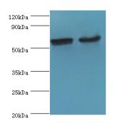 CYP2J2 Antibody - Western blot. All lanes: CYP2J2 antibody at 4 ug/ml. Lane 1: mouse skeletal muscle tissue. Lane 2: rat liver tissue. Secondary antibody: Goat polyclonal to rabbit at 1:10000 dilution. Predicted band size: 58 kDa. Observed band size: 58 kDa.