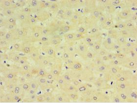 CYP2J2 Antibody - Immunohistochemistry of paraffin-embedded human liver using antibody at 1:100 dilution.