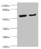 CYP2J2 Antibody - Western blot All lanes: CYP2J2 antibody at 4µg/ml Lane 1: Mouse skeletal muscle tissue Lane 2: Rat liver tissue Secondary Goat polyclonal to rabbit IgG at 1/10000 dilution Predicted band size: 58 kDa Observed band size: 58 kDa