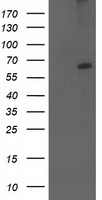 CYP2J2 Antibody - HEK293T cells were transfected with the pCMV6-ENTRY control (Left lane) or pCMV6-ENTRY CYP2J2 (Right lane) cDNA for 48 hrs and lysed. Equivalent amounts of cell lysates (5 ug per lane) were separated by SDS-PAGE and immunoblotted with anti-CYP2J2.