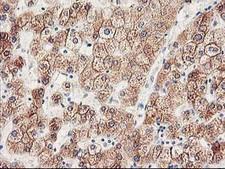 CYP2J2 Antibody - IHC of paraffin-embedded Human liver tissue using anti-CYP2J2 mouse monoclonal antibody.