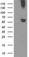 CYP2J2 Antibody - HEK293T cells were transfected with the pCMV6-ENTRY control (Left lane) or pCMV6-ENTRY CYP2J2 (Right lane) cDNA for 48 hrs and lysed. Equivalent amounts of cell lysates (5 ug per lane) were separated by SDS-PAGE and immunoblotted with anti-CYP2J2.