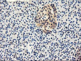 CYP2J2 Antibody - IHC of paraffin-embedded Human pancreas tissue using anti-CYP2J2 mouse monoclonal antibody.