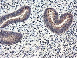 CYP2J2 Antibody - IHC of paraffin-embedded Human endometrium tissue using anti-CYP2J2 mouse monoclonal antibody.