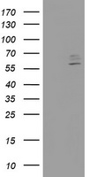 CYP2J2 Antibody - HEK293T cells were transfected with the pCMV6-ENTRY control (Left lane) or pCMV6-ENTRY CYP2J2 (Right lane) cDNA for 48 hrs and lysed. Equivalent amounts of cell lysates (5 ug per lane) were separated by SDS-PAGE and immunoblotted with anti-CYP2J2.
