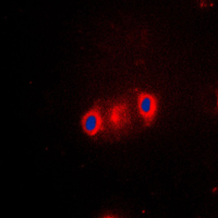CYP2J2 Antibody - Immunofluorescent analysis of Cytochrome P450 2J2 staining in A549 cells. Formalin-fixed cells were permeabilized with 0.1% Triton X-100 in TBS for 5-10 minutes and blocked with 3% BSA-PBS for 30 minutes at room temperature. Cells were probed with the primary antibody in 3% BSA-PBS and incubated overnight at 4 C in a humidified chamber. Cells were washed with PBST and incubated with a DyLight 594-conjugated secondary antibody (red) in PBS at room temperature in the dark. DAPI was used to stain the cell nuclei (blue).