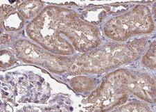 CYP2J2 Antibody - 1:100 staining human kidney tissue by IHC-P. The tissue was formaldehyde fixed and a heat mediated antigen retrieval step in citrate buffer was performed. The tissue was then blocked and incubated with the antibody for 1.5 hours at 22°C. An HRP conjugated goat anti-rabbit antibody was used as the secondary.