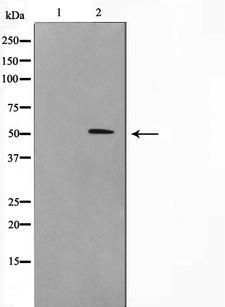 CYP2J2 Antibody - Western blot analysis on HT29 cell lysates using Cytochrome P450 2J2 antibody. The lane on the left is treated with the antigen-specific peptide.