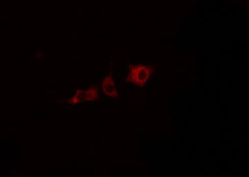 CYP2J2 Antibody - Staining HepG2 cells by IF/ICC. The samples were fixed with PFA and permeabilized in 0.1% Triton X-100, then blocked in 10% serum for 45 min at 25°C. The primary antibody was diluted at 1:200 and incubated with the sample for 1 hour at 37°C. An Alexa Fluor 594 conjugated goat anti-rabbit IgG (H+L) antibody, diluted at 1/600, was used as secondary antibody.