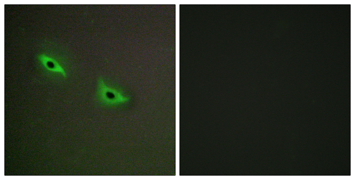 CYP2S1 Antibody - Immunofluorescence analysis of A549 cells, using Cytochrome P450 2S1 Antibody. The picture on the right is blocked with the synthesized peptide.
