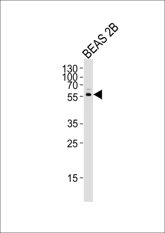CYP2S1 Antibody - Western blot of lysate from BEAS 2B cell line, using CYP2S1 Antibody. Antibody was diluted at 1:1000. A goat anti-rabbit IgG H&L (HRP) at 1:5000 dilution was used as the secondary antibody. Lysate at 35ug.