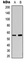 CYP2S1 Antibody - Western blot analysis of Cytochrome P450 2S1 expression in HepG2 (A); COLO205 (B) whole cell lysates.