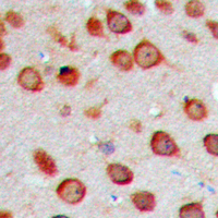 CYP2S1 Antibody - Immunohistochemical analysis of Cytochrome P450 2S1 staining in human brain formalin fixed paraffin embedded tissue section. The section was pre-treated using heat mediated antigen retrieval with sodium citrate buffer (pH 6.0). The section was then incubated with the antibody at room temperature and detected using an HRP conjugated compact polymer system. DAB was used as the chromogen. The section was then counterstained with hematoxylin and mounted with DPX.