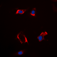 CYP2S1 Antibody - Immunofluorescent analysis of Cytochrome P450 2S1 staining in HepG2 cells. Formalin-fixed cells were permeabilized with 0.1% Triton X-100 in TBS for 5-10 minutes and blocked with 3% BSA-PBS for 30 minutes at room temperature. Cells were probed with the primary antibody in 3% BSA-PBS and incubated overnight at 4 deg C in a humidified chamber. Cells were washed with PBST and incubated with a DyLight 594-conjugated secondary antibody (red) in PBS at room temperature in the dark. DAPI was used to stain the cell nuclei (blue).