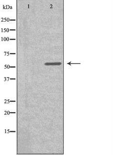 CYP2S1 Antibody - Western blot analysis of extracts of HuvEc cells using Cytochrome P450 2S1 antibody. The lane on the left is treated with the antigen-specific peptide.