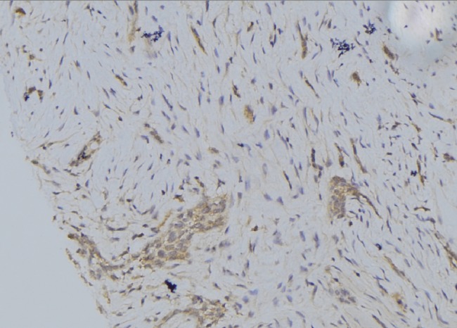 CYP2S1 Antibody - 1:100 staining human lung tissue by IHC-P. The sample was formaldehyde fixed and a heat mediated antigen retrieval step in citrate buffer was performed. The sample was then blocked and incubated with the antibody for 1.5 hours at 22°C. An HRP conjugated goat anti-rabbit antibody was used as the secondary.