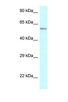 CYP2U1 Antibody - CYP2U1 antibody Western blot of Jurkat Cell lysate. Antibody concentration 1 ug/ml.  This image was taken for the unconjugated form of this product. Other forms have not been tested.