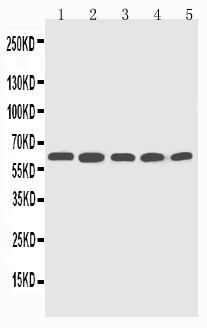 CYP2U1 Antibody - WB of CYP2U1 antibody. Lane 1: HELA Cell Lysate. Lane 2: MCF-7 Cell Lysate. Lane 3: M453 Cell Lysate. Lane 4: COLO320 Cell Lysate. Lane 5: HT1080 Cell Lysate..