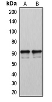 CYP2U1 Antibody - Western blot analysis of Cytochrome P450 2U1 expression in LOVO (A); A2058 (B) whole cell lysates.