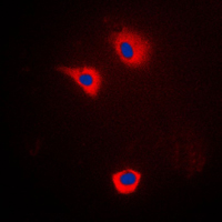 CYP2U1 Antibody - Immunofluorescent analysis of Cytochrome P450 2U1 staining in LOVO cells. Formalin-fixed cells were permeabilized with 0.1% Triton X-100 in TBS for 5-10 minutes and blocked with 3% BSA-PBS for 30 minutes at room temperature. Cells were probed with the primary antibody in 3% BSA-PBS and incubated overnight at 4 C in a humidified chamber. Cells were washed with PBST and incubated with a DyLight 594-conjugated secondary antibody (red) in PBS at room temperature in the dark. DAPI was used to stain the cell nuclei (blue).