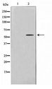 CYP2U1 Antibody - Western blot of HeLa cell lysate using Cytochrome P450 2U1 Antibody