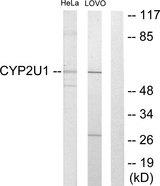 CYP2U1 Antibody - Western blot analysis of extracts from HeLa cells and Lovo cells, using Cytochrome P450 2U1 antibody.