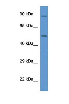 CYP2W1 Antibody - CYP2W1 antibody Western blot of Fetal Lung lysate. Antibody concentration 1 ug/ml.  This image was taken for the unconjugated form of this product. Other forms have not been tested.