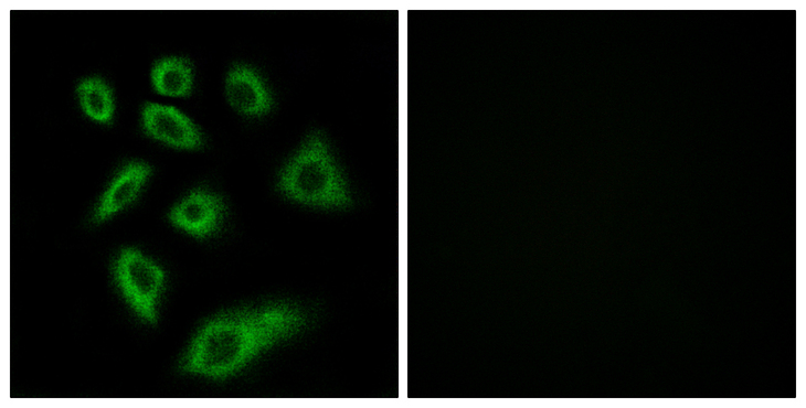 CYP2W1 Antibody - Immunofluorescence analysis of HUVEC cells, using Cytochrome P450 2W1 Antibody. The picture on the right is blocked with the synthesized peptide.
