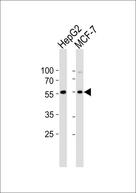 CYP2W1 Antibody - Western blot of lysates from HepG2, MCF-7 cell line (from left to right), using CYP2W1 Antibody. Antibody was diluted at 1:1000 at each lane. A goat anti-rabbit IgG H&L (HRP) at 1:10000 dilution was used as the secondary antibody. Lysates at 35ug per lane.