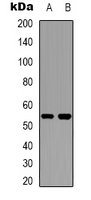 CYP2W1 Antibody - Western blot analysis of Cytochrome P450 2W1 expression in HeLa (A); HepG2 (B) whole cell lysates.
