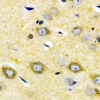 CYP2W1 Antibody - Immunohistochemical analysis of Cytochrome P450 2W1 staining in human brain formalin fixed paraffin embedded tissue section. The section was pre-treated using heat mediated antigen retrieval with sodium citrate buffer (pH 6.0). The section was then incubated with the antibody at room temperature and detected with HRP and DAB as chromogen. The section was then counterstained with hematoxylin and mounted with DPX.