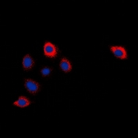 CYP2W1 Antibody - Immunofluorescent analysis of Cytochrome P450 2W1 staining in HeLa cells. Formalin-fixed cells were permeabilized with 0.1% Triton X-100 in TBS for 5-10 minutes and blocked with 3% BSA-PBS for 30 minutes at room temperature. Cells were probed with the primary antibody in 3% BSA-PBS and incubated overnight at 4 deg C in a humidified chamber. Cells were washed with PBST and incubated with a DyLight 594-conjugated secondary antibody (red) in PBS at room temperature in the dark. DAPI was used to stain the cell nuclei (blue).