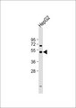 CYP2W1 Antibody - Anti-Cytochrome P450 2W1 Antibody at 1:1000 dilution + HepG2 whole cell lysate Lysates/proteins at 20 ug per lane. Secondary Goat Anti-Rabbit IgG, (H+L), Peroxidase conjugated at 1:10000 dilution. Predicted band size: 54 kDa. Blocking/Dilution buffer: 5% NFDM/TBST.