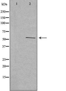 CYP2W1 Antibody - Western blot analysis of extracts of HeLa cells using Cytochrome P450 2W1 antibody. The lane on the left is treated with the antigen-specific peptide.