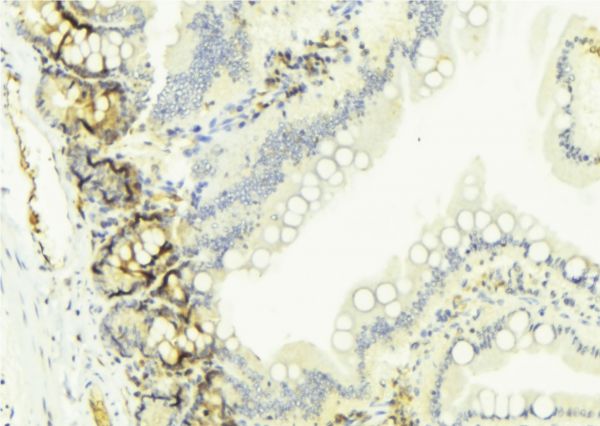 CYP2W1 Antibody - 1:100 staining mouse colon tissue by IHC-P. The sample was formaldehyde fixed and a heat mediated antigen retrieval step in citrate buffer was performed. The sample was then blocked and incubated with the antibody for 1.5 hours at 22°C. An HRP conjugated goat anti-rabbit antibody was used as the secondary.