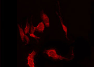 CYP2W1 Antibody - Staining HepG2 cells by IF/ICC. The samples were fixed with PFA and permeabilized in 0.1% Triton X-100, then blocked in 10% serum for 45 min at 25°C. The primary antibody was diluted at 1:200 and incubated with the sample for 1 hour at 37°C. An Alexa Fluor 594 conjugated goat anti-rabbit IgG (H+L) Ab, diluted at 1/600, was used as the secondary antibody.