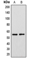 CYP39A1 Antibody - Western blot analysis of Cytochrome P450 39A1 expression in HeLa (A); HUVEC (B) whole cell lysates.