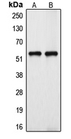 CYP39A1 Antibody - Western blot analysis of Cytochrome P450 39A1 expression in HeLa (A); HUVEC (B) whole cell lysates.