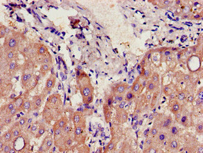 CYP39A1 Antibody - Immunohistochemistry image of paraffin-embedded human liver tissue at a dilution of 1:100