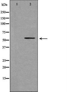 CYP39A1 Antibody - Western blot analysis of extracts of LOVO cells using Cytochrome P450 39A1 antibody. The lane on the left is treated with the antigen-specific peptide.